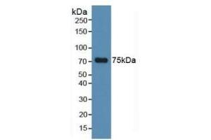 Detection of MAPT in Human Hela Cells using Polyclonal Antibody to Tau Protein (MAPT) (tau 抗体  (AA 130-386))