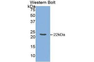 Western Blotting (WB) image for anti-Ferritin, Light Polypeptide (FTL) (AA 1-175) antibody (ABIN7436849)