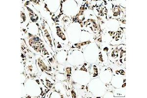 IHC analysis of IRF9 using anti-IRF9 antibody (ABIN4886637). (IRF9 抗体  (AA 1-110))