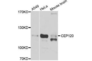 Western blot analysis of extracts of various cell lines, using CEP120 antibody.