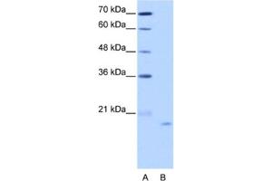 Western Blotting (WB) image for anti-Nucleolar Protein 6 (NOL6) antibody (ABIN2462296) (Nucleolar Protein 6 抗体)