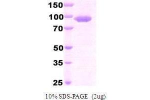 Dipeptidyl-Peptidase 4 (DPP4) (AA 39-766) peptide (His tag)