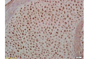 Formalin-fixed and paraffin embedded mouse embryo labeled with Rabbit Anti Phospho-MEF2A (Thr312) Polyclonal Antibody, Unconjugated (ABIN743768) at 1:200 followed by conjugation to the secondary antibody and DAB staining (MEF2A 抗体  (pThr312))