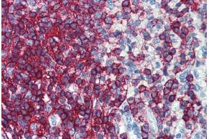 Human Spleen: Formalin-Fixed, Paraffin-Embedded (FFPE) (CD44 抗体  (FITC))