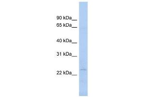 NAT9 antibody used at 1 ug/ml to detect target protein. (NAT9 抗体)
