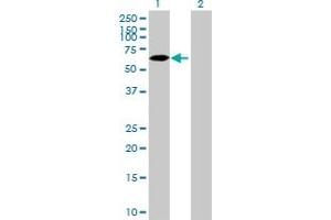 Western Blot analysis of ZNF653 expression in transfected 293T cell line by ZNF653 MaxPab polyclonal antibody. (ZNF653 抗体  (AA 1-615))