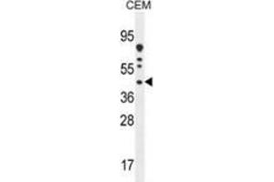 Western blot analysis in CEM cell line lysates (35ug/lane) using DNAJC22 Antibody (C-term).