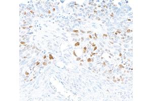anti-Ubiquitin-Like, Containing PHD and RING Finger Domains, 1 (UHRF1) (AA 1-50) antibody