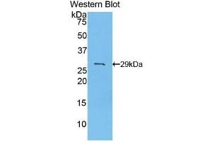 PDK2 抗体  (AA 155-379)