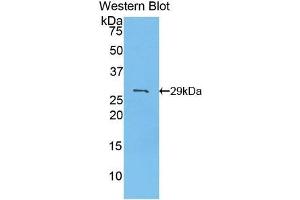 Detection of Recombinant PDK2, Mouse using Polyclonal Antibody to Pyruvate Dehydrogenase Kinase Isozyme 2 (PDK2) (PDK2 抗体  (AA 155-379))