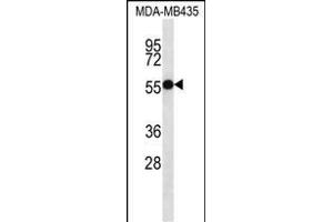 Western Blotting (WB) image for anti-Ankyrin Repeat and SOCS Box Containing 4 (ASB4) (AA 226-255), (C-Term) antibody (ABIN657170)