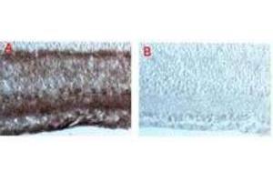 IF - Dab1 Antibody Immunohistochemical staining after cryofixation and sectioning of mouse brain tissue using (A) a 1:5,000 dilution of anti-Dab-1 and (B) 1:5,000 dilution of pre-immune serum followed by processing with HRP Goat anti-Rabbit IgG [H&L] and chromogenic substrate. (DAB1 抗体  (AA 400-555))