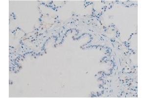 ABIN6256297 and ABIN6267410 at 1/200 staining Rat lung tissue sections by IHC-P. (Connexin 43/GJA1 抗体  (pSer368))