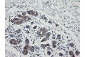 Immunohistochemical staining of paraffin-embedded Human breast tissue using anti-VBP1 mouse monoclonal antibody. (VBP1 抗体)
