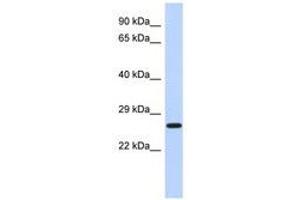 Image no. 1 for anti-EF-Hand Domain Family, Member D2 (EFHD2) (N-Term) antibody (ABIN6741472) (EFHD2 抗体  (N-Term))