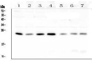 Western blot analysis of RAB11B using anti-RAB11B antibody (ABIN6719364).