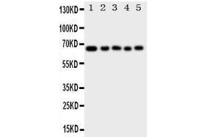 Anti-MBD4 antibody, Western blotting Lane 1: Rat Brain Tissue Lysate Lane 2: Rat Kidney Tissue Lysate Lane 3: A549 Cell Lysate Lane 4: HELA Cell Lysate Lane 5: MCF-7 Cell Lysate