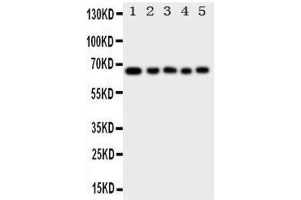 MBD4 抗体  (C-Term)