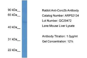 Western Blotting (WB) image for anti-Coronin, Actin Binding Protein, 2B (CORO2B) (C-Term) antibody (ABIN2784791)