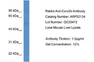 WB Suggested Anti-Coro2b  Antibody Titration: 0.