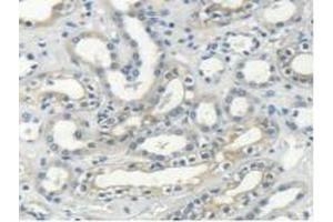 Immunohistochemistry (IHC) image for anti-Myosin (AA 1069-1331) antibody (ABIN7439273)