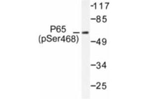 Image no. 1 for anti-Nuclear Factor-kB p65 (NFkBP65) (pSer468) antibody (ABIN318083) (NF-kB p65 抗体  (pSer468))