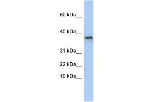WB Suggested Anti-GLYAT Antibody Titration:  0. (GLYAT 抗体  (N-Term))