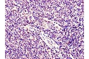 Immunohistochemistry of paraffin-embedded human lymph node tissue using ABIN7171071 at dilution of 1:100 (SMARCD1 抗体  (AA 7-124))