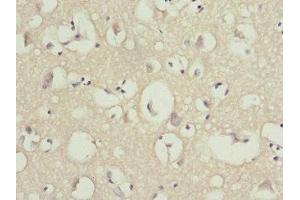 Immunohistochemistry of paraffin-embedded human brain tissue using ABIN7162207 at dilution of 1:100 (OMG 抗体  (AA 190-420))