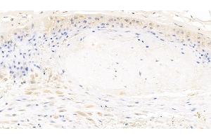 Detection of MYH9 in Human Placenta Tissue using Polyclonal Antibody to Myosin Heavy Chain 9, Non Muscle (MYH9) (Myosin 9 抗体  (AA 1740-1960))