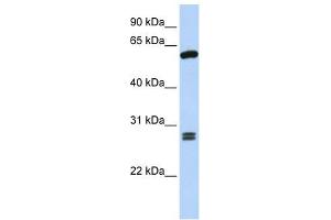 ACD antibody used at 1 ug/ml to detect target protein. (ACD 抗体)