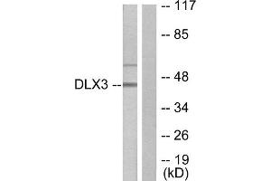 Western Blotting (WB) image for anti-Distal-Less Homeobox 3 (DLX3) (Internal Region) antibody (ABIN1848996) (DLX3 抗体  (Internal Region))