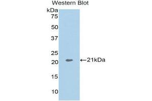 Western Blotting (WB) image for anti-Actin Related Protein 2/3 Complex, Subunit 4, 20kDa (ARPC4) (AA 3-163) antibody (ABIN3202609) (ARPC4 抗体  (AA 3-163))