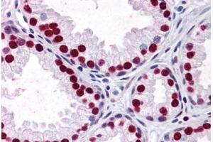 Human Prostate: Formalin-Fixed, Paraffin-Embedded (FFPE) (SMAD6 抗体  (AA 285-385))