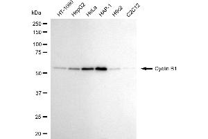 Western blotting analysis using cyclin B1 antibody (ABIN7798190).