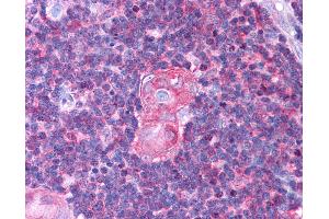 Anti-NFKB1 antibody IHC of human thymus.