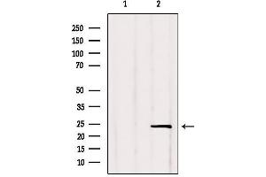 Western blot analysis of extracts from Rat lung, using RGS2 Antibody. (RGS2 抗体  (Internal Region))