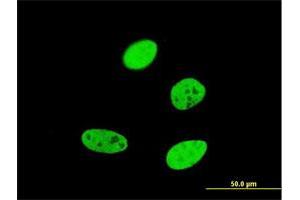 Immunofluorescence of monoclonal antibody to FOXA2 on HeLa cell. (FOXA2 抗体  (AA 363-457))