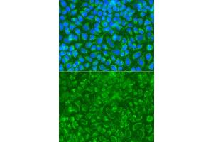 Immunofluorescence analysis of A549 cell using STRN antibody. (Striatin 抗体)