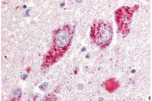 Human Basal Nucleus of Meynert (formalin-fixed, paraffin-embedded) stained with GPR20 antibody ABIN213331 at 10 ug/ml followed by biotinylated goat anti-rabbit IgG secondary antibody ABIN481713, alkaline phosphatase-streptavidin and chromogen. (GPR20 抗体  (N-Term))