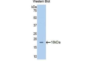 Detection of Recombinant SLC3A2, Human using Polyclonal Antibody to Solute Carrier Family 3, Member 2 (SLC3A2) (SLC3A2 抗体  (AA 213-349))