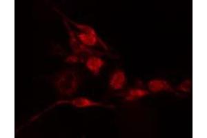 ABIN6275522 staining  Hela cells by IF/ICC. (Septin 2 抗体  (Internal Region))