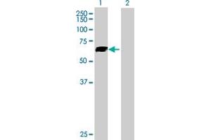 Western Blotting (WB) image for anti-Solute Carrier Family 7 (Cationic Amino Acid Transporter, Y+ System), Member 1 (SLC7A1) (AA 1-629) antibody (ABIN520252)