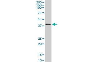 SPHK1 monoclonal antibody (M01), clone 1D6. (SPHK1 抗体  (AA 1-384))