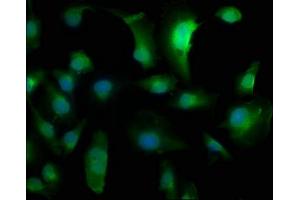 Immunofluorescence staining of U251 cells with ABIN7160783 at 1:133, counter-stained with DAPI. (NECAB1 抗体  (N-Term))