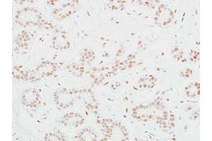 Immunohistochemistry (IHC) image for anti-Mediator Complex Subunit 12 (MED12) (AA 2127-2177) antibody (ABIN7453977) (Recombinant MED12 抗体  (AA 2127-2177))