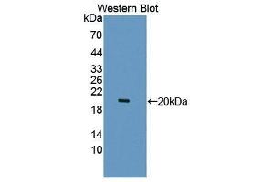 Western Blotting (WB) image for anti-Leukocyte Cell-Derived Chemotaxin 2 (LECT2) (AA 1-151) antibody (ABIN1868950) (LECT2 抗体  (AA 1-151))