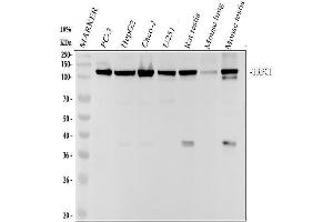 Western blot analysis of TRPC1 using anti-TRPC1 antibody (ABIN7606592).