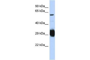 Host:  Rabbit  Target Name:  SETMAR  Sample Type:  Jurkat Whole Cell lysates  Antibody Dilution:  1. (SETMAR 抗体  (C-Term))