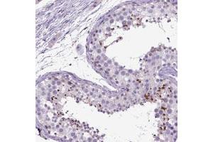 Immunohistochemical staining (Formalin-fixed paraffin-embedded sections) of human testis with NEK5 polyclonal antibody  shows strong cytoplasmic positivity in spermatozoa and spermatids.
